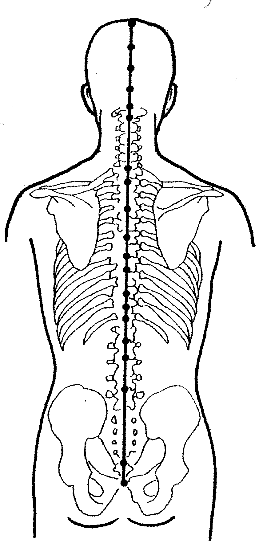The Du Meridian in acupuncture, an alternative medicine for spinal cord injury (SCI) and physical disability