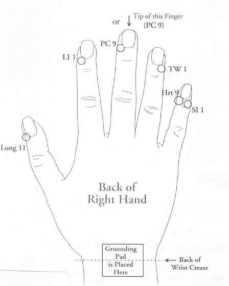 Acupuncture Points Wrist