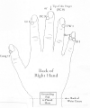 Laser Acupuncture Therapy for Carpal Tunnel Syndrome and Hand Therapy